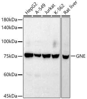 Western Blot: N-Acetylmannosamine Kinase/GNE Antibody (5T9K10) [NBP3-33260] - Western blot analysis of various lysates using N-Acetylmannosamine Kinase/GNE Rabbit mAb at 1:1000 dilution.Secondary antibody: HRP-conjugated Goat anti-Rabbit IgG (H+L) at 1:10000 dilution.Lysates/proteins: 25ug per lane.Blocking buffer: 3% nonfat dry milk in TBST.Detection: ECL Basic Kit.Exposure time: 180s.