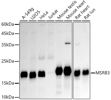 Western Blot: MSRB3 Antibody (2A2G9) [NBP3-33261] - Western blot analysis of various lysates, using MSRB3 Rabbit mAb at 1:1000 dilution.Secondary antibody: HRP-conjugated Goat anti-Rabbit IgG (H+L) at 1:10000 dilution.Lysates/proteins: 25ug per lane.Blocking buffer: 3% nonfat dry milk in TBST.Detection: ECL Basic Kit.Exposure time: 90s.