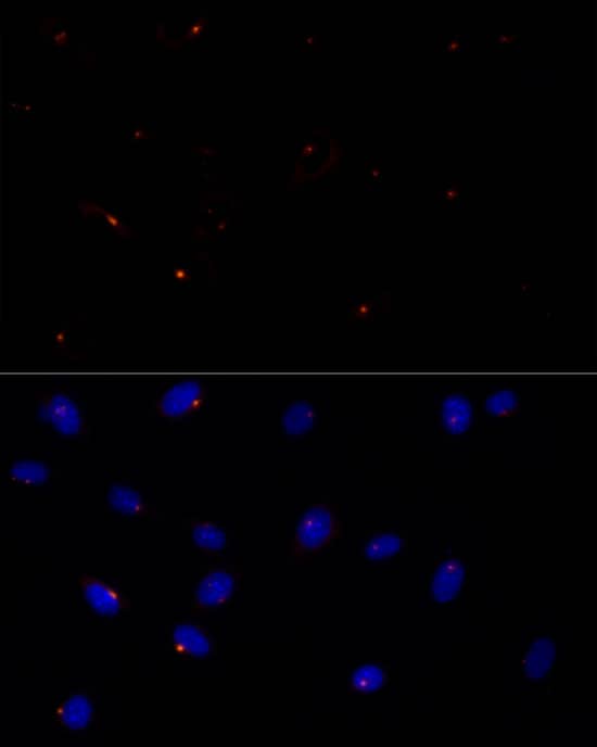 Immunocytochemistry/ Immunofluorescence: FGFR1OP Antibody (2T2F9) [NBP3-33266] - Immunofluorescence analysis of NIH/3T3 cells using FGFR1OP Rabbit mAb at dilution of 1:50 (40x lens). Secondary antibody: Cy3-conjugated Goat anti-Rabbit IgG (H+L) at 1:500 dilution. Blue: DAPI for nuclear staining.