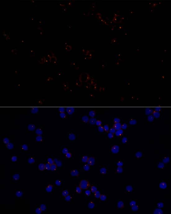 Immunocytochemistry/ Immunofluorescence: FGFR1OP Antibody (2T2F9) [NBP3-33266] - Immunofluorescence analysis of NIH/3T3 cells using FGFR1OP Rabbit mAb at dilution of 1:50 (40x lens). Secondary antibody: Cy3-conjugated Goat anti-Rabbit IgG (H+L) at 1:500 dilution. Blue: DAPI for nuclear staining.