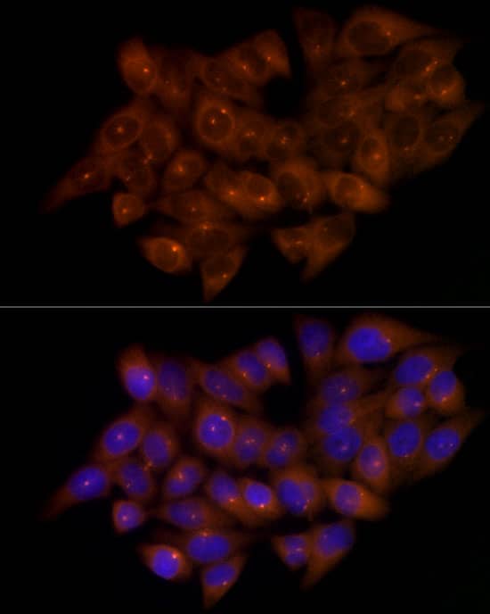 Western Blot: FGFR1OP Antibody (2T2F9) [NBP3-33266] - Western blot analysis of lysates from HeLa cells using FGFR1OP Rabbit mAb at 1:1000 dilution incubated overnight at 4C.Secondary antibody: HRP-conjugated Goat anti-Rabbit IgG (H+L) at 1:10000 dilution.Lysates/proteins: 25 ug per lane.Blocking buffer: 3% nonfat dry milk in TBST.Detection: ECL Basic Kit.Exposure time: 90s.