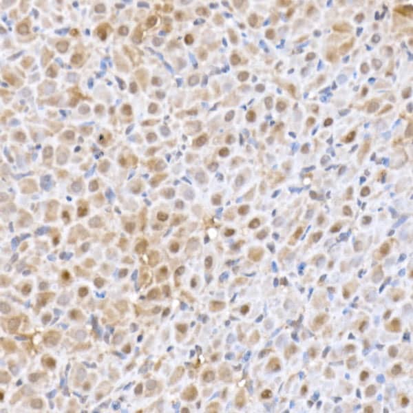 Immunohistochemistry: UbcH5a/UBE2D1 Antibody (8E6O0) [NBP3-33268] - Immunohistochemistry analysis of paraffin-embedded Rat ovary using UbcH5a/UBE2D1 Rabbit mAb at dilution of 1:50 (40x lens). High pressure antigen retrieval performed with 0.01M Citrate Bufferr (pH 6.0) prior to IHC staining.