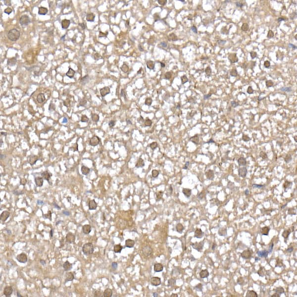 Immunohistochemistry: UbcH5a/UBE2D1 Antibody (8E6O0) [NBP3-33268] - Immunohistochemistry analysis of paraffin-embedded Mouse liver using UbcH5a/UBE2D1 Rabbit mAb at dilution of 1:50 (40x lens). High pressure antigen retrieval performed with 0.01M Citrate Bufferr (pH 6.0) prior to IHC staining.