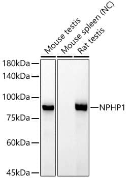 Western Blot: Nephronophthisis Antibody (6T10Z4) [NBP3-33269] - Western blot analysis of various lysates, using Nephronophthisis Rabbit mAb at 1:1000 dilution.Secondary antibody: HRP-conjugated Goat anti-Rabbit IgG (H+L) at1:10000 dilution.Lysates/proteins: 25ug per lane.Blocking buffer: 3% nonfat dry milk in TBST.Detection: ECL Basic Kit.Negative control (NC): Mouse spleenExposure time: 90s.