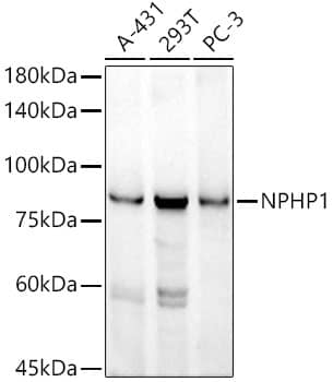 Western Blot: Nephronophthisis Antibody (6T10Z4) [NBP3-33269] - Western blot analysis of various lysates, using Nephronophthisis Rabbit mAb at 1:1000 dilution.Secondary antibody: HRP-conjugated Goat anti-Rabbit IgG (H+L) at1:10000 dilution.Lysates/proteins: 25ug per lane.Blocking buffer: 3% nonfat dry milk in TBST.Detection: ECL Basic Kit.Exposure time: 180s.