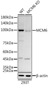 <b>Genetic Strategies Validation. </b>Western Blot: MCM6 Antibody (8Z6Q3) [NBP3-33270] - Western blot analysis of lysates from wild type (WT) and MCM6 knockdown (KD) 293T cells, using [KD Validated] MCM6 Rabbit mAb  at1:1000 dilution.Secondary antibody: HRP Goat Anti-Rabbit IgG (H+L)  at 1:10000 dilution.Lysates/proteins: 25ug per lane.Blocking buffer: 3% nonfat dry milk in TBST.Detection: ECL Basic Kit .Exposure time: 60s.
