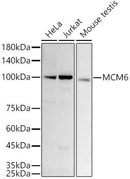 Western Blot: MCM6 Antibody (8Z6Q3) [NBP3-33270] - Western blot analysis of various lysates using [KD Validated] MCM6 Rabbit mAb at1:1000 dilution.Secondary antibody: HRP-conjugated Goat anti-Rabbit IgG (H+L) at 1:10000 dilution.Lysates/proteins: 25ug per lane.Blocking buffer: 3% nonfat dry milk in TBST.Detection: ECL Basic Kit.Exposure time: 60s.