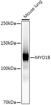 Western Blot: Myosin 1B Antibody (3W1C6) [NBP3-33271] - Western blot analysis of lysates from Mouse lung, using Myosin 1B Rabbit mAb at1:1000 dilution.Secondary antibody: HRP-conjugated Goat anti-Rabbit IgG (H+L) at 1:10000 dilution.Lysates/proteins: 25ug per lane.Blocking buffer: 3% nonfat dry milk in TBST.Detection: ECL Basic Kit.Exposure time: 30s.