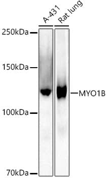 Western Blot: Myosin 1B Antibody (3W1C6) [NBP3-33271] - Western blot analysis of various lysates using Myosin 1B Rabbit mAb at1:1000 dilution.Secondary antibody: HRP-conjugated Goat anti-Rabbit IgG (H+L) at 1:10000 dilution.Lysates/proteins: 25ug per lane.Blocking buffer: 3% nonfat dry milk in TBST.Detection: ECL Basic Kit.Exposure time: 180s.