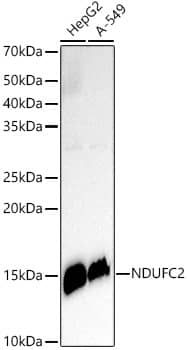 Western Blot: NDUFC2 Antibody (4G4S0) [NBP3-33272] - Western blot analysis of various lysates, using NDUFC2 Rabbit mAb at1:500 dilution.Secondary antibody: HRP-conjugated Goat anti-Rabbit IgG (H+L) at 1:10000 dilution.Lysates/proteins: 25ug  per lane.Blocking buffer: 3% nonfat dry milk in TBST.Detection: ECL Enhanced Kit.Exposure time: 180s.