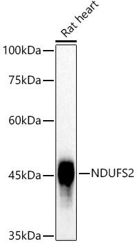 Western Blot: NDUFS2 Antibody (9W2N4) [NBP3-33273] - Western blot analysis of lysates from Rat heart, using NDUFS2 Rabbit mAb at1:1000 dilution.Secondary antibody: HRP-conjugated Goat anti-Rabbit IgG (H+L) at 1:10000 dilution.Lysates/proteins: 25ug per lane.Blocking buffer: 3% nonfat dry milk in TBST.Detection: ECL Basic Kit.Exposure time: 3s.