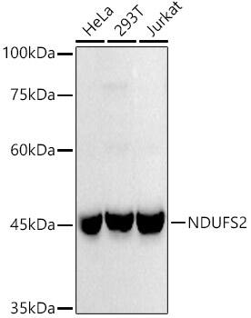 Western Blot: NDUFS2 Antibody (9W2N4) [NBP3-33273] - Western blot analysis of various lysates using NDUFS2 Rabbit mAb at1:1000 dilution.Secondary antibody: HRP-conjugated Goat anti-Rabbit IgG (H+L) at 1:10000 dilution.Lysates/proteins: 25ug per lane.Blocking buffer: 3% nonfat dry milk in TBST.Detection: ECL Basic Kit.Exposure time: 90s.