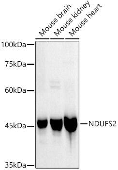 Western Blot: NDUFS2 Antibody (9W2N4) [NBP3-33273] - Western blot analysis of various lysates, using NDUFS2 Rabbit mAb at1:1000 dilution.Secondary antibody: HRP-conjugated Goat anti-Rabbit IgG (H+L) at 1:10000 dilution.Lysates/proteins: 25ug  per lane.Blocking buffer: 3% nonfat dry milk in TBST.Detection: ECL Basic Kit.Exposure time: 60s.