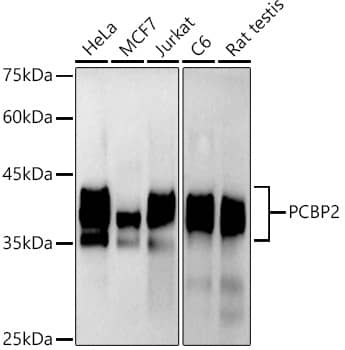 Western Blot: PCBP2 Antibody (4K6I6) [NBP3-33275] - Western blot analysis of various lysates using PCBP2 Rabbit mAb at1:1000 dilution.Secondary antibody: HRP-conjugated Goat anti-Rabbit IgG (H+L) at 1:10000 dilution.Lysates/proteins: 25ug per lane.Blocking buffer: 3% nonfat dry milk in TBST.Detection: ECL Basic Kit.Exposure time: 180s.