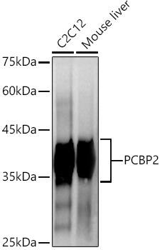 Western Blot: PCBP2 Antibody (4K6I6) [NBP3-33275] - Western blot analysis of various lysates using PCBP2 Rabbit mAb at1:1000 dilution.Secondary antibody: HRP-conjugated Goat anti-Rabbit IgG (H+L) at 1:10000 dilution.Lysates/proteins: 25ug per lane.Blocking buffer: 3% nonfat dry milk in TBST.Detection: ECL Enhanced Kit.Exposure time: 90s.