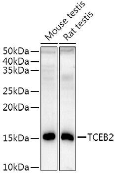 Western Blot: TCEB2 Antibody (7T5C1) [NBP3-33277] - Western blot analysis of various lysates using TCEB2 Rabbit mAb at1:1000 dilution.Secondary antibody: HRP-conjugated Goat anti-Rabbit IgG (H+L) at 1:10000 dilution.Lysates/proteins: 25ug per lane.Blocking buffer: 3% nonfat dry milk in TBST.Detection: ECL Enhanced Kit.Exposure time: 180s.