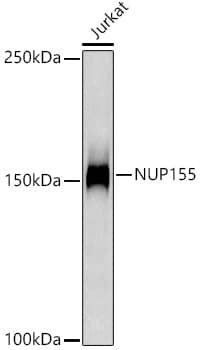 Western Blot: NUP155 Antibody (9I10M5) [NBP3-33279] - Western blot analysis of lysates from Jurkat cells, using NUP155 Rabbit mAb at1:1000 dilution.Secondary antibody: HRP-conjugated Goat anti-Rabbit IgG (H+L) at 1:10000 dilution.Lysates/proteins: 25ug  per lane.Blocking buffer: 3% nonfat dry milk in TBST.Detection: ECL Basic Kit.Exposure time: 180s.