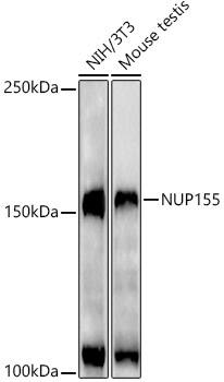 Western Blot: NUP155 Antibody (9I10M5) [NBP3-33279] - Western blot analysis of various lysates, using NUP155 Rabbit mAb at1:1000 dilution.Secondary antibody: HRP-conjugated Goat anti-Rabbit IgG (H+L) at 1:10000 dilution.Lysates/proteins: 25ug  per lane.Blocking buffer: 3% nonfat dry milk in TBST.Detection: ECL Enhanced Kit.Exposure time: 90s.