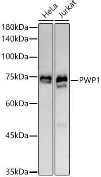 Western Blot: PWP1 Antibody (7G8K0) [NBP3-33282] - Western blot analysis of various lysates using PWP1 Rabbit mAb at1:1000 dilution.Secondary antibody: HRP-conjugated Goat anti-Rabbit IgG (H+L) at 1:10000 dilution.Lysates/proteins: 25ug per lane.Blocking buffer: 3% nonfat dry milk in TBST.Detection: ECL Basic Kit.Exposure time: 30s.