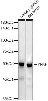 Western Blot: PNK Antibody (7J6Y6) [NBP3-33284] - Western blot analysis of various lysates using PNK Rabbit mAb at1:1000 dilution.Secondary antibody: HRP-conjugated Goat anti-Rabbit IgG (H+L) at 1:10000 dilution.Lysates/proteins: 25ug per lane.Blocking buffer: 3% nonfat dry milk in TBST.Detection: ECL Enhanced Kit.Exposure time: 180s.