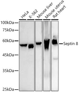 Western Blot: Septin-8 Antibody (5A2J9) [NBP3-33285] - Western blot analysis of various lysates using Septin-8 Rabbit mAb at1:1000 dilution.Secondary antibody: HRP-conjugated Goat anti-Rabbit IgG (H+L) at 1:10000 dilution.Lysates/proteins: 25ug per lane.Blocking buffer: 3% nonfat dry milk in TBST.Detection: ECL Basic Kit.Exposure time: 90s.