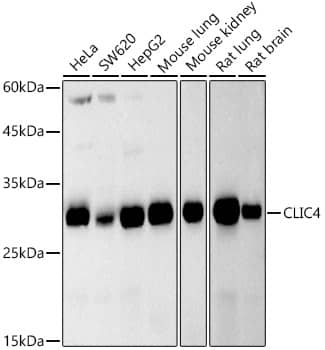 Western Blot: CLIC4 Antibody (6O0W5) [NBP3-33286] - Western blot analysis of various lysates, using CLIC4 Rabbit mAb at 1:500 dilution.Secondary antibody: HRP-conjugated Goat anti-Rabbit IgG (H+L) at 1:10000 dilution.Lysates/proteins: 25ug per lane.Blocking buffer: 3% nonfat dry milk in TBST.Detection: ECL Basic Kit.Exposure time: 90s.