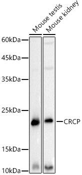 Western Blot: CRCP Antibody (0I6F10) [NBP3-33287] - Western blot analysis of various lysates using CRCP Rabbit mAb at1:500 dilution.Secondary antibody: HRP-conjugated Goat anti-Rabbit IgG (H+L) at 1:10000 dilution.Lysates/proteins: 25ug per lane.Blocking buffer: 3% nonfat dry milk in TBST.Detection: ECL Basic Kit.Exposure time: 3s.