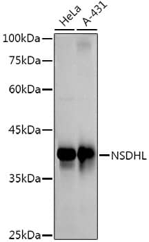 Western Blot: NSDHL Antibody (3K3Q6) [NBP3-33288] - Western blot analysis of various lysates using NSDHL Rabbit mAb at 1:1000 dilution.Secondary antibody: HRP-conjugated Goat anti-Rabbit IgG (H+L) at 1:10000 dilution.Lysates/proteins: 25ug per lane.Blocking buffer: 3% nonfat dry milk in TBST.Detection: ECL Basic Kit.Exposure time: 60s.