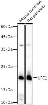 Western Blot: Ufc1 Antibody (8V0X7) [NBP3-33289] - Western blot analysis of various lysates, using Ufc1 Rabbit mAb at 1:1000 dilution.Secondary antibody: HRP-conjugated Goat anti-Rabbit IgG (H+L) at 1:10000 dilution.Lysates/proteins: 25ug per lane.Blocking buffer: 3% nonfat dry milk in TBST.Detection: ECL Basic Kit.Exposure time: 90s.