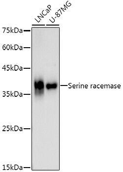 Western Blot: Serine racemase Antibody (0T6G3) [NBP3-33292] - Western blot analysis of various lysates using Serine racemase Rabbit mAb at1:1000 dilution.Secondary antibody: HRP-conjugated Goat anti-Rabbit IgG (H+L) at 1:10000 dilution.Lysates/proteins: 25ug per lane.Blocking buffer: 3% nonfat dry milk in TBST.Detection: ECL Basic Kit.Exposure time: 90s.