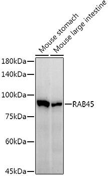 Western Blot: RASEF Antibody (7L8S8) [NBP3-33294] - Western blot analysis of various lysates, using RASEF Rabbit mAb at1:1000 dilution.Secondary antibody: HRP-conjugated Goat anti-Rabbit IgG (H+L) at 1:10000 dilution.Lysates/proteins: 25ug per lane.Blocking buffer: 3% nonfat dry milk in TBST.Detection: ECL Enhanced Kit.Exposure time: 60s.