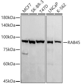 Western Blot: RASEF Antibody (7L8S8) [NBP3-33294] - Western blot analysis of various lysates, using RASEF Rabbit mAb at1:1000 dilution.Secondary antibody: HRP-conjugated Goat anti-Rabbit IgG (H+L) at 1:10000 dilution.Lysates/proteins: 25ug per lane.Blocking buffer: 3% nonfat dry milk in TBST.Detection: ECL Basic Kit.Exposure time: 180s.