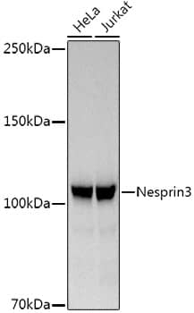 Western Blot: Nesprin-3 Antibody (5P10J3) [NBP3-33295] - Western blot analysis of various lysates, using Nesprin-3 Rabbit mAb at1:1000 dilution.Secondary antibody: HRP-conjugated Goat anti-Rabbit IgG (H+L) at 1:10000 dilution.Lysates/proteins: 25ug per lane.Blocking buffer: 3% nonfat dry milk in TBST.Detection: ECL Basic Kit.Exposure time: 60s.