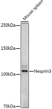 Western Blot: Nesprin-3 Antibody (5P10J3) [NBP3-33295] - Western blot analysis of lysates from Mouse spleen, using Nesprin-3 Rabbit mAb at1:1000 dilution.Secondary antibody: HRP-conjugated Goat anti-Rabbit IgG (H+L) at 1:10000 dilution.Lysates/proteins: 25ug per lane.Blocking buffer: 3% nonfat dry milk in TBST.Detection: ECL Enhanced Kit.Exposure time: 180s.