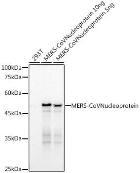 Western Blot: MERS-CoV Nucleoprotein Antibody (1R8L7) [NBP3-33298] - Western blot analysis of various lysates, using MERS-CoV Nucleoprotein Rabbit mAb at  1:3000 dilution.Secondary antibody: HRP-conjugated Goat anti-Rabbit IgG (H+L) at 1:10000 dilution.Lysates/proteins: 25ug per lane.Blocking buffer: 3% nonfat dry milk in TBST.Detection: ECL Basic Kit.Exposure time: 3s.