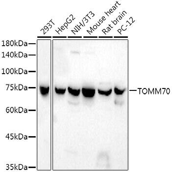 Western Blot: TOM70 Antibody (6H6F2) [NBP3-33301] - Western blot analysis of various lysates using TOM70 Rabbit mAb at1:1800 dilution.Secondary antibody: HRP-conjugated Goat anti-Rabbit IgG (H+L) at 1:10000 dilution.Lysates/proteins: 25ug per lane.Blocking buffer: 3% nonfat dry milk in TBST.Detection: ECL Basic Kit.Exposure time: 90s.