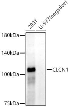 Western Blot: CLCN1 Antibody (0P2M8) [NBP3-33303] - Western blot analysis of various lysates, using CLCN1 Rabbit mAb at 1:20000 dilution.Secondary antibody: HRP-conjugated Goat anti-Rabbit IgG (H+L) at 1:10000 dilution.Lysates/proteins: 25ug per lane.Blocking buffer: 3% nonfat dry milk in TBST.Detection: ECL Enhanced Kit.Exposure time: 60s.