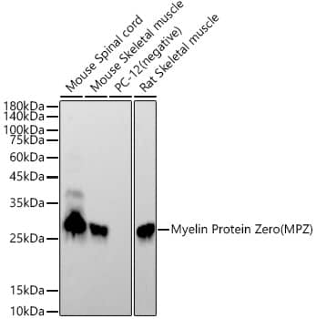 Western Blot: Myelin Protein Zero Antibody (3C4D1) [NBP3-33312] - Western blot analysis of various lysates using Myelin Protein Zero(MPZ) Rabbit mAb at1:19000 dilution.Secondary antibody: HRP-conjugated Goat anti-Rabbit IgG (H+L) at 1:10000 dilution.Lysates/proteins: 25ug per lane.Blocking buffer: 3% nonfat dry milk in TBST.Detection: ECL Basic Kit.Exposure time: 60s.