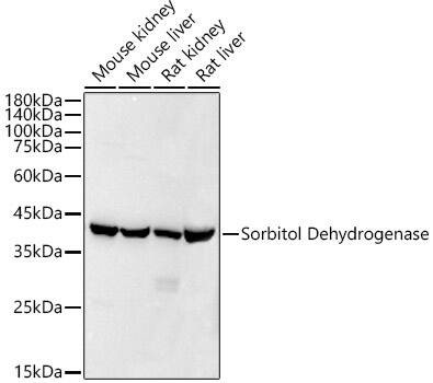 Western Blot: Sorbitol Dehydrogenase Antibody (9Q3B10) [NBP3-33313] - Western blot analysis of various lysates using Sorbitol Dehydrogenase Rabbit mAb at1:20000 dilution.Secondary antibody: HRP-conjugated Goat anti-Rabbit IgG (H+L) at 1:10000 dilution.Lysates/proteins: 25ug per lane.Blocking buffer: 3% nonfat dry milk in TBST.Detection: ECL Basic Kit.Exposure time: 10s.