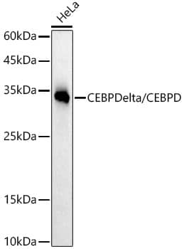 Western Blot: CEBP Delta Antibody (2O1A6) [NBP3-33314] - Western blot analysis of lysates from HeLa cells, using CEBP Delta Rabbit mAb at 1:200000 dilution.Secondary antibody: HRP-conjugated Goat anti-Rabbit IgG (H+L) at 1:10000 dilution.Lysates/proteins: 25ug per lane.Blocking buffer: 3% nonfat dry milk in TBST.Detection: ECL Basic Kit.Exposure time: 180s.