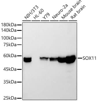 Western Blot: SOX11 Antibody (5K1J5) [NBP3-33321] - Western blot analysis of various lysates using SOX11 Rabbit mAb at1:20000 dilution.Secondary antibody: HRP-conjugated Goat anti-Rabbit IgG (H+L) at 1:10000 dilution.Lysates/proteins: 25ug per lane.Blocking buffer: 3% nonfat dry milk in TBST.Detection: ECL Basic Kit.Exposure time: 10s.