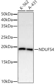 Western Blot: Ndufs4 Antibody (2J4W2) [NBP3-33322] - Western blot analysis of various lysates using Ndufs4 Rabbit mAb at1:20000 dilution.Secondary antibody: HRP-conjugated Goat anti-Rabbit IgG (H+L) at 1:10000 dilution.Lysates/proteins: 25ug per lane.Blocking buffer: 3% nonfat dry milk in TBST.Detection: ECL Basic Kit.Exposure time: 60s.