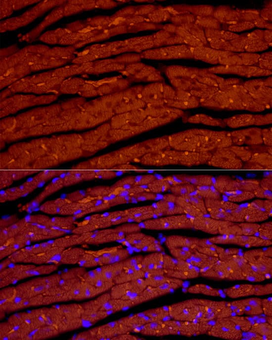 Immunohistochemistry: Atrial Natriuretic Peptide/ANP Antibody (2C5S5) [NBP3-33325] - Confocal imaging of paraffin-embedded mouse heart  using NPPA Rabbit mAb  followed by a further incubation with Cy3 Goat Anti-Rabbit IgG (H+L)(Red). Objective: 40x. Perform high pressure antigen retrieval with 0.01 M citrate buffer (pH 6.0) prior to IF staining.