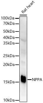 Western Blot: Atrial Natriuretic Peptide/ANP Antibody (2C5S5) [NBP3-33325] - Western blot analysis of lysates from wild type (WT) and 293T cells transfected with NPPA using NPPA Rabbit mAb at 1:5000 dilution. Secondary antibody: HRP-conjugated Goat anti-Rabbit IgG (H+L) at 1:10000 dilution.Lysates/proteins: 25 μg per lane.Blocking buffer: 3% nonfat dry milk in TBST.Detection: ECL Enhanced Kit.Exposure time: 60s.