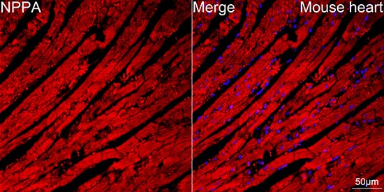 Immunocytochemistry/ Immunofluorescence: Atrial Natriuretic Peptide/ANP Antibody (2C5S5) [NBP3-33325] - Confocal imaging of paraffin-embedded mouse heart using Atrial Natriuretic Peptide/ANP Rabbit mAb  followed by a further incubation with Cy3 Goat Anti-Rabbit IgG (H+L). Objective: 40x. Perform high pressure antigen retrieval with 0.01 M citrate buffer (pH 6.0) prior to IF staining.