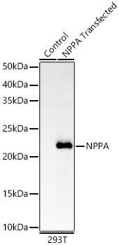 Western Blot: Atrial Natriuretic Peptide/ANP Antibody (2C5S5) [NBP3-33325] - Western blot analysis of lysates from wild type (WT) and 293T cells transfected with Atrial Natriuretic Peptide/ANP using Atrial Natriuretic Peptide/ANP Rabbit mAb at 1:5000 dilution. Secondary antibody: HRP-conjugated Goat anti-Rabbit IgG (H+L) at 1:10000 dilution.Lysates/proteins: 25 ug per lane.Blocking buffer: 3% nonfat dry milk in TBST.Detection: ECL Enhanced Kit.Exposure time: 60s.