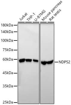 Western Blot: NDP52 Antibody (5O8Y6) [NBP3-33327] - Western blot analysis of various lysates using NDP52 Rabbit mAb at1:2000 dilution.Secondary antibody: HRP-conjugated Goat anti-Rabbit IgG (H+L) at 1:10000 dilution.Lysates/proteins: 25ug per lane.Blocking buffer: 3% nonfat dry milk in TBST.Detection: ECL Basic Kit.Exposure time: 30s.