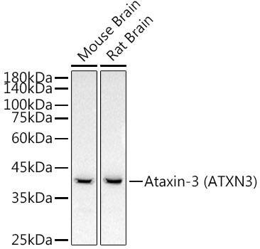 Western Blot: Ataxin-3 Antibody (7B2I1) [NBP3-33328] - Western blot analysis of lysates from various lysates, using Ataxin-3Rabbit mAb at 1:2000 dilution.Secondary antibody: HRP-conjugated Goat anti-Rabbit IgG (H+L) at 1:10000 dilution.Lysates/proteins: 25ug per lane.Blocking buffer: 3% nonfat dry milk in TBST.Detection: ECL Basic Kit.Exposure time: 30s.