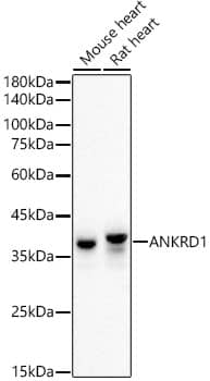 Western Blot: ANKRD1 Antibody (2H4T1) [NBP3-33329] - Western blot analysis of various lysates using ANKRD1 Rabbit mAb at1:2000 dilution.Secondary antibody: HRP-conjugated Goat anti-Rabbit IgG (H+L) at 1:10000 dilution.Lysates/proteins: 25ug per lane.Blocking buffer: 3% nonfat dry milk in TBST.Detection: ECL Basic Kit.Exposure time: 60s.