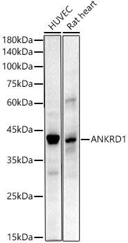 Western Blot: ANKRD1 Antibody (6C3I2) [NBP3-33330] - Western blot analysis of various lysates using ANKRD1 Rabbit mAb at1:2000 dilution.Secondary antibody: HRP-conjugated Goat anti-Rabbit IgG (H+L) at 1:10000 dilution.Lysates/proteins: 25ug per lane.Blocking buffer: 3% nonfat dry milk in TBST.Detection: ECL Enhanced Kit.Exposure time: 90s.